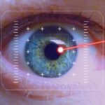 Benefits Lasik Eye Surgery